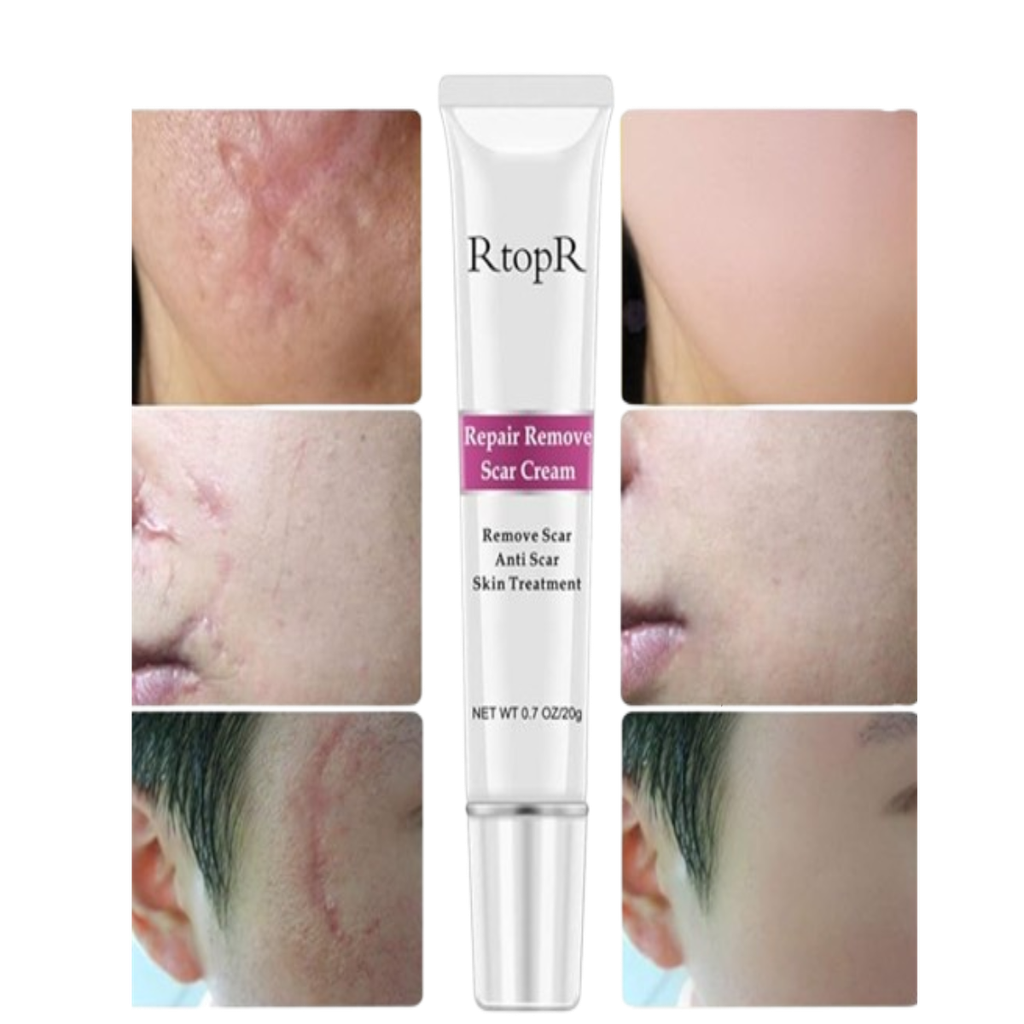 Crema Reparadora De Cicatriz RtopR